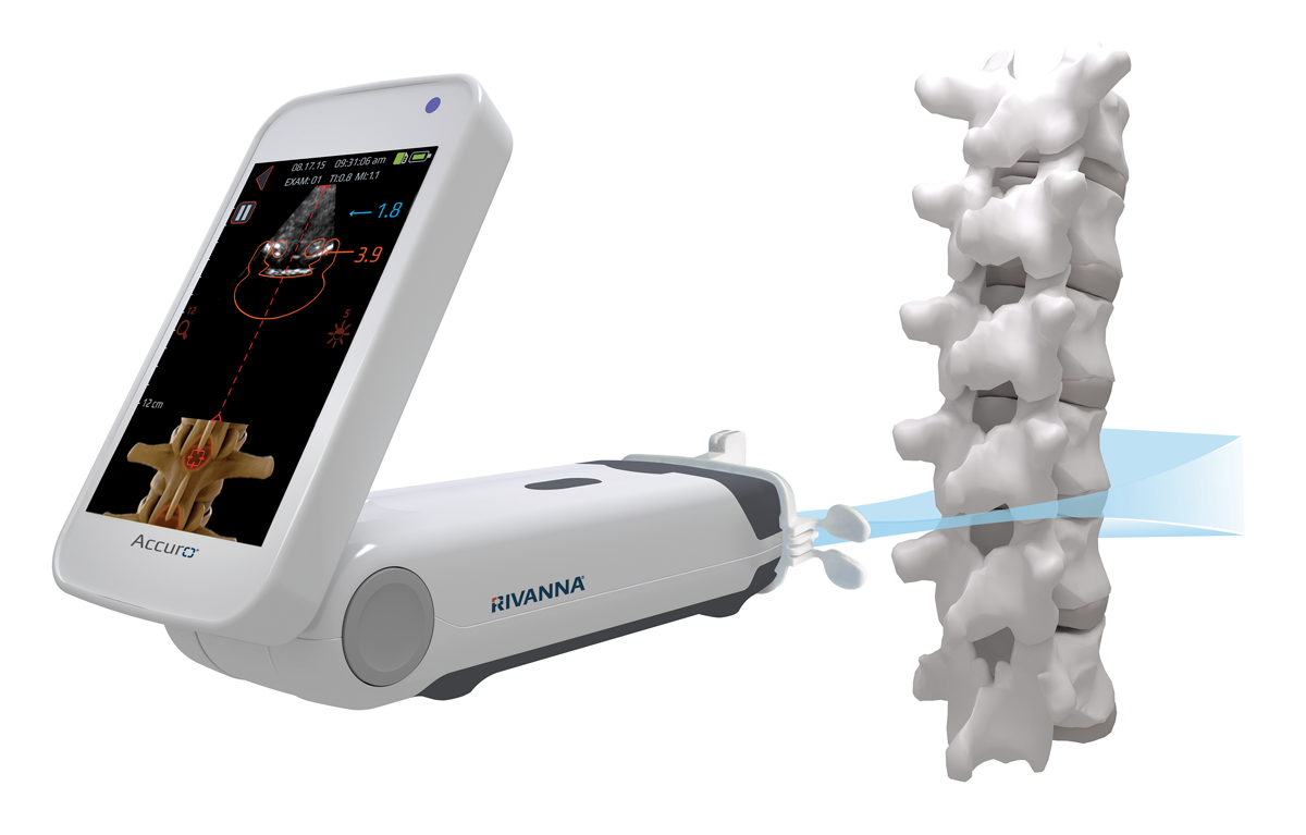 Accuro device scanning spine