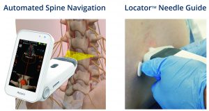 Automated spinal navigation and LocatorTM needle guide