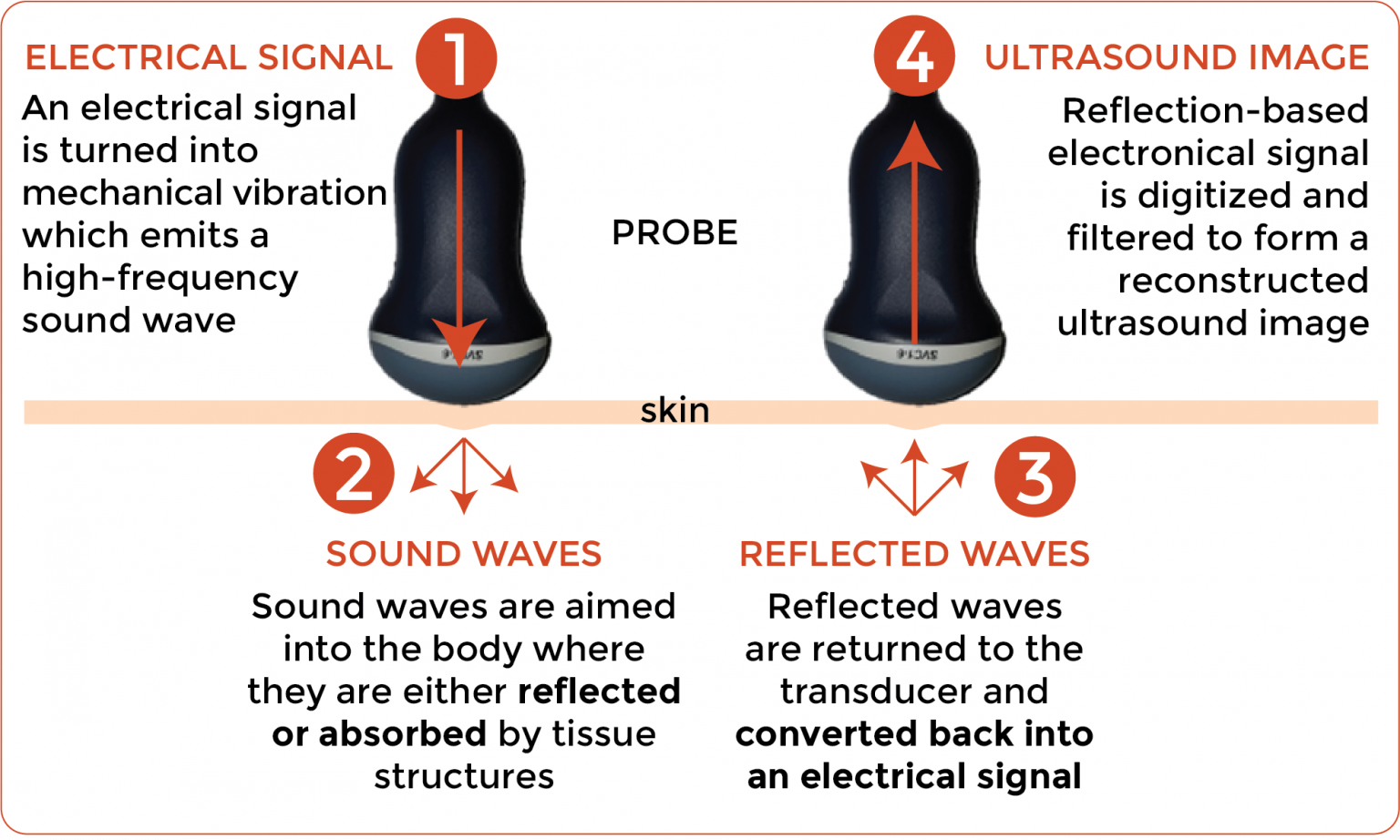 Ultrasound-transducer-electronic-signal-to-sound-waves