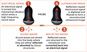 how an ultrasound transducer works
