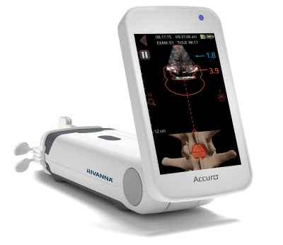 rivanna-accuro-mark-epidural-space-lumbar-scouting-technique Accuro with Locator needle guide