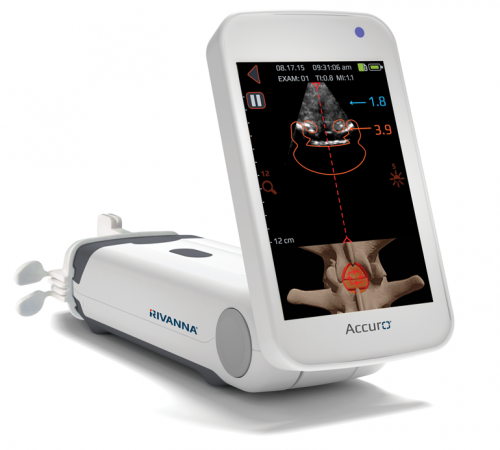 rivanna-accuro-mark-epidural-space-lumbar-scouting-técnica rivanna-accuro-mark-epidural-space-lumbar-scouting-técnica