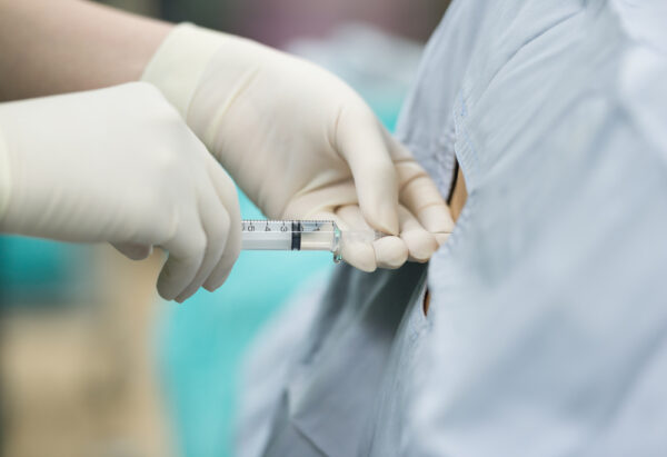 Spinal Nerve Block