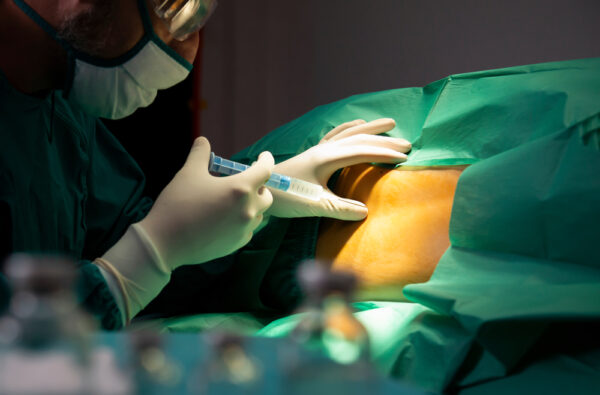 Neuraxial Anesthesia in Obese Patients