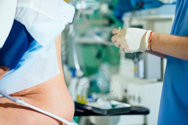 Gloved Hands Of A Doctor Giving Epidural Anesthesia