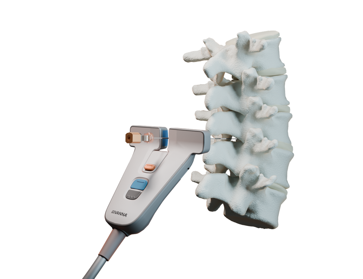 The Dual-Array Probe