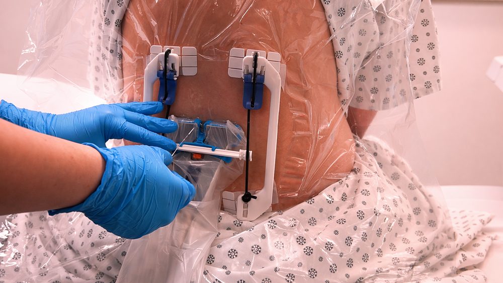 Sterile drape with integrated elastic bands securing the Dual-Array probe hands-free